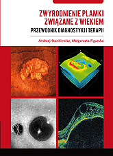 Zwyrodnienie plamki związane z wiekiem – przewodnik diagnostyki i terapii