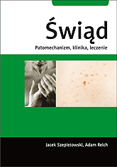 Świąd. Patomechanizm, klinika, leczenie