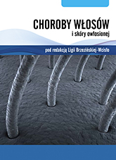Choroby włosów i skóry owłosionej