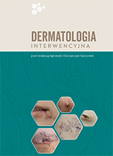 Dermatologia interwencyjna