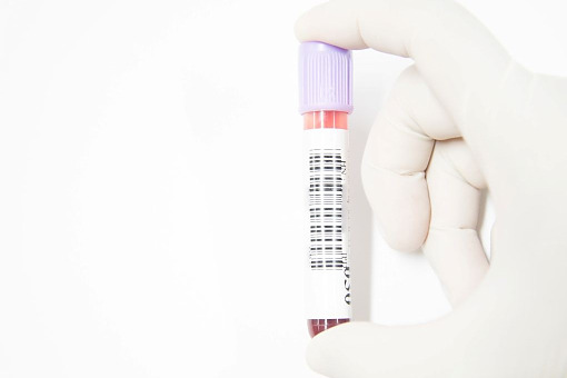 MZ: w ramach profilaktyki test wykrywający onkogenne typy wirusa HPV