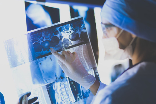 Jak AI może wspomóc radiologów?