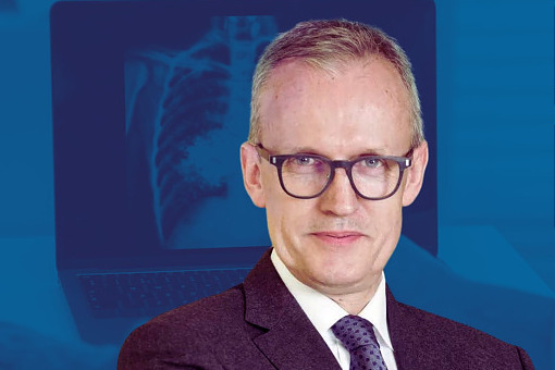 Pilnie potrzebujemy wdrożenia Lung Cancer Units