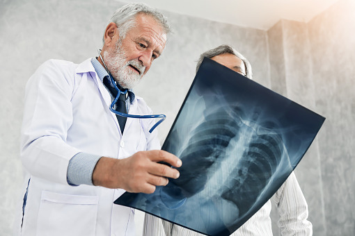 Benralizumab w astmie i POChP