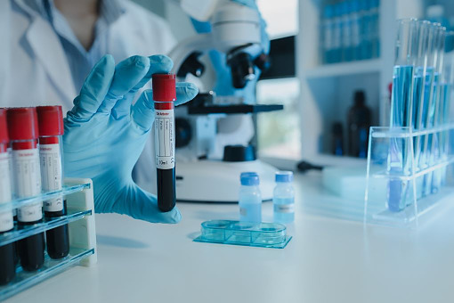 Pierwsze wytyczne dotyczące testów oznaczania biomarkerów w chorobie Alzheimera