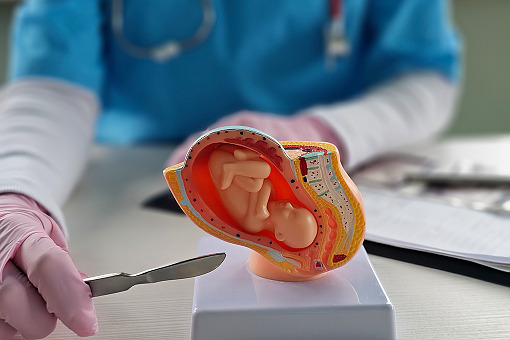 Gdzie tną na potęgę