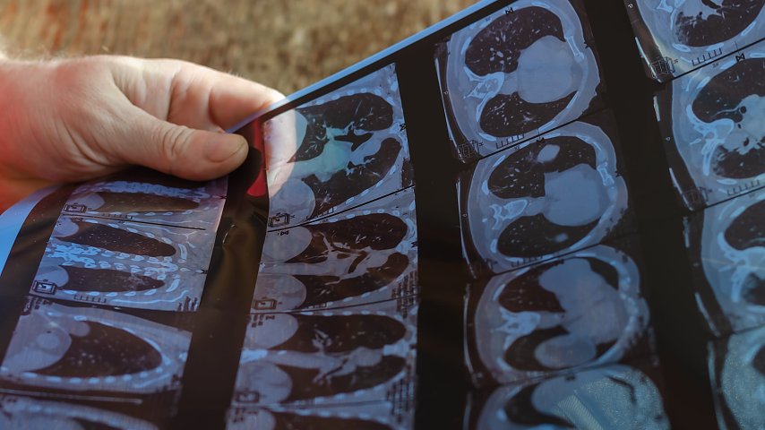 Polscy badacze opracowali nową metodę analizy obrazu rezonansu